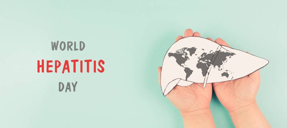 Leberorgan mit Virus infiziert, World Hepatitis Day, Diagnose von Krebs, Zirrhose Gesundheitsproblem, alkoholische Fettleber *** Liver organ with Virus infected, World Hepatitis Day, Diagnosis from Cancer, Cirrhosis Health problem, Alcoholic Fatty liver 1133607418