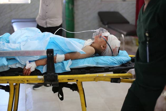 Palestinian child seriously injured in Israeli strike on Bureij Refugee Camp GAZA, PALESTINE - MAY 31: (EDITOR S NOTE: Image depicts graphic content) A seriously injured Palestinian child is brought to the Al-Awda Hospital in the Nuseirat Refugee Camp for treatment after an Israeli military strike on the Bureij Refugee Camp in the central Gaza Strip, Gaza, Palestine on May 31, 2026. Hassan Jedi Anadolu Gaza Palestine. Editorial use only. Please get in touch for any other usage.  Copyright: x2026xAnadoluxHassanxJedix