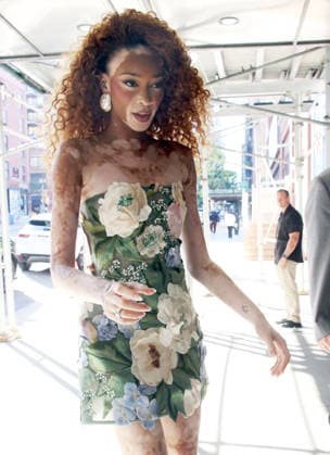 NEW YORK, NY - JUNE 1: Winnie Harlow seen in New York City on June 1, 2026. Copyright: xRWx