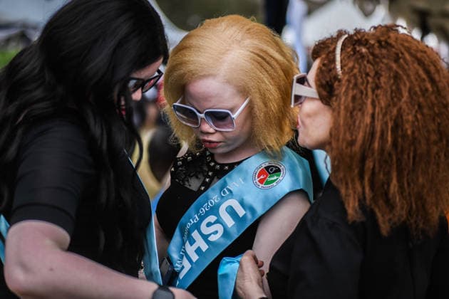 International Albinism Awareness Day in Kenya THIKA, KENYA - JUNE 13: People with albinism take part in activities marking International Albinism Awareness Day, advocating for equal participation in society and raising awareness about the challenges they face across Africa, including discrimination, exclusion and violent attacks, on June 13, 2026, in Thika, Kenya. The annual observance, led by the United Nations, aims to combat prejudice surrounding albinism, protect fundamental human rights and highlight global efforts to end violence against people with albinism. Gerald Anderson Anadolu Thika Kenya. Editorial use only. Please get in touch for any other usage.  Copyright: x2026xAnadoluxGeraldxAndersonx