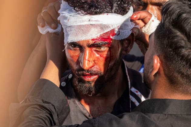June 24, 2026, Srinagar, Jammu And Kashmir, India: A man applies a bandage to a mourner during a Muharram procession on the seventh day of Muharram in Rainawari, a neighbourhood in Srinagar, the summer capital of Indian Kashmir. Srinagar India  - ZUMAf191 20260624_zip_f191_003 Copyright: xUmarxFarooqx
