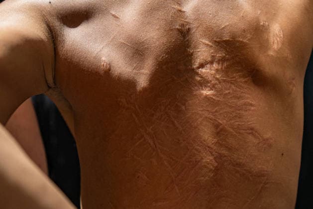 Commemoration of the Ashura holiday by the Shia community in Barcelona: A man’s back during the annual Ashura procession on June 26, 2026, in Barcelona, Catalonia, Spain. This solemn liturgical and mourning ceremony, organized by the Al Qaim Islamic Center, brings together hundreds of members of the Shia community in the streets of the Ciutat Vella district—on a route from Sant Pere Mitjà Street to the Arc de Triomf— to commemorate the martyrdom of Imam Husayn, grandson of the Prophet Muhammad, through penitential marches, sermons, and commemorative chants. JUNE 26, 2026 Lorena Sopê Barcelona, Catalonia Barcelona, Catalonia Spain  Copyright: xLorenaxSopÃªnax 7624716