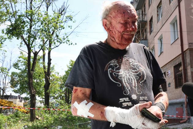 Russia strikes five-storey residential building in Kharkiv with missile An injured local resident stands outside a five-storey residential building damaged in a Russian missile strike, Kharkiv, Ukraine, on July 8, 2026. Russian forces struck the residential building in the Nemyshlianskyi district of the city, partially destroying the fifth floor. The attack killed two people and injured at least 23 residents, including four children, Credit:Viacheslav Madiievskyi Ukrinform Avalon Ukraine, Kharkiv  Copyright: xViacheslavxMadiievskyix xUkrinformx xAvalonx 1115318014