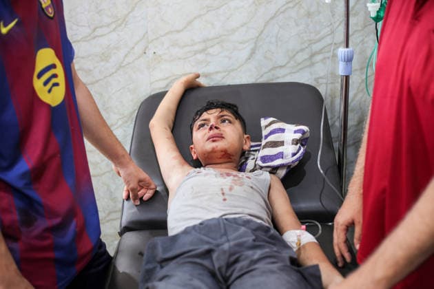 Wounded Palestinians receive treatment at Al-Awda Hospital in Nuseirat Wounded Palestinians, including children, receive treatment at Al-Awda Hospital in the Nuseirat refugee camp, central Gaza Strip, on July 17, 2026. According to the information provided, an Israeli army strike targeted a gathering of Palestinians in the Nuseirat refugee camp, killing seven people and injuring many others. Photo by Moiz Salhi apaimages Nusairat Gaza Strip Palestinian Territory 170726_Nusairat_MS_00(7) Copyright: xapaimagesxMoizxSalhixx xapaimagesx