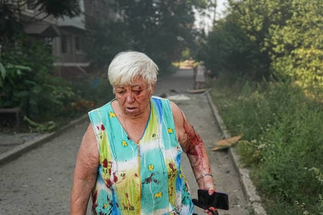August 18, 2026, Kramatorsk, NULL, Ukraine: A woman with injuries to her arm and face following a Russian strike on Kramatorsk, west of the Donbas region in Ukraine, on the morning of August 18, 2026. Kramatorsk Ukraine - ZUMAa252 20260818_zip_a252_009 Copyright: xDavidxAllignonx