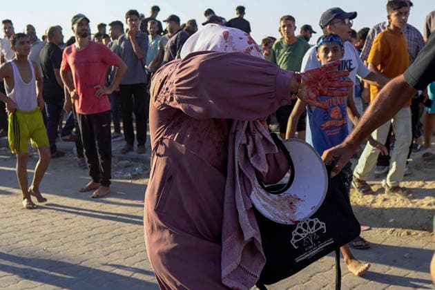 Gaza City Seashore Shelling A Palestinian woman raises a blood-covered hand following shelling along the seashore in Gaza City, Palestinian Territories on August 18, 2026. At least six Palestinians, including a child, were killed and 10 others injured on Tuesday in an Israeli airstrike that hit a cafe in the seaport area west of Gaza City, according to a medical source. Gaza Gaza Strip Palestinian Territories Copyright: xMohammedxAlxQumsanx