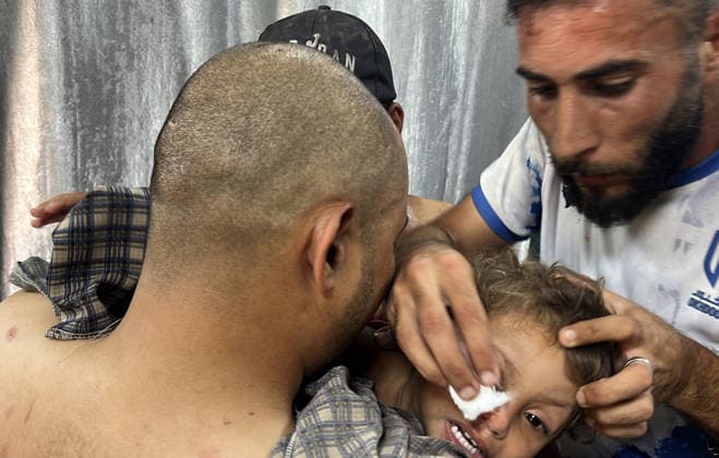 4-year-old child loses life in Israeli attack on Gaza KHAN YUNIS, GAZA, PALESTINE - AUGUST 23: An injured child receiving treatment at Nasser Hospital after an Israeli drone strike in Khan Yunis, Gaza, Palestine, on August 23, 2026. Despite the ceasefire, the Israeli army carried out a drone strike in Khan Yunis, with those injured in the attack taken to Nasser Hospital for treatment. Abed Rahim Khatib Anadolu Khan Yunis Gaza. Editorial use only. Please get in touch for any other usage.  Copyright: x2026xAnadoluxAbedxRahimxKhatibx