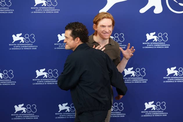September 3, 2026, Venice Lido, Veneto, Italy: DOMHNALL GLEESON and ORLANDO BLOOM have fun during the Bucking Fastard photocall at the 83rd Venice Film Festival at Sala Grande in Venice Lido, Italy Venice Lido Italy  - ZUMAc179 20260903_zep_c179_051 Copyright: xMickaelxChavetx