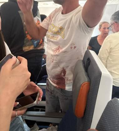 (260930) -- TEL AVIV, Sept. 30, 2026 () -- This photo released by an Israeli media agency shows a passenger with bloodstains on his clothes aboard a Flydubai commercial flight from Dubai to Tel Aviv, on Sept. 30, 2026. Israeli security agencies were investigating an incident aboard a Flydubai flight from Dubai to Tel Aviv after the aircraft transmitted an emergency signal and descended sharply before diverting to Saudi Arabia on Wednesday. () (SpotNews) ISRAEL-FLYDUBAI COCKPIT INCIDENT-INVESTIGATION Xinhua 