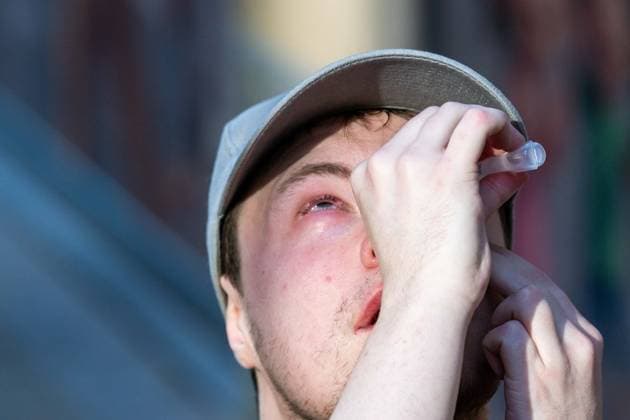 A youth treats his eyes with sterile water after being hit with teargas as students gather outside several schools in Liege during a protest against education reforms and budget cuts, on Tuesday 6 October 2026. Yesterday police arrested 16 people after the protests turned violent. The protests in French-speaking Belgium have been ongoing for months, following a series of reforms and budget cuts introduced by the French Community Government.  JONASxROOSENS 188939287