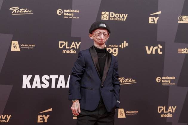 Influencer Michiel Vandeweert has died