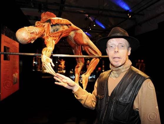 Gunther von Hagens has died