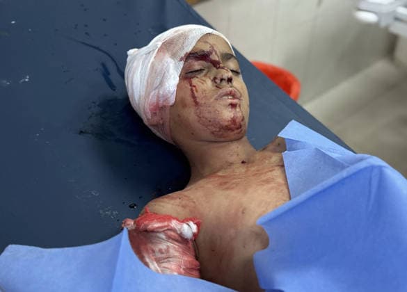 Middle East conflict, Gaza, dead and injured after Israeli attacks on Khan Yunis