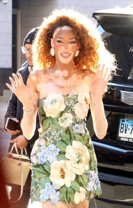 Celebrity, Winnie Harlow on the road in New York