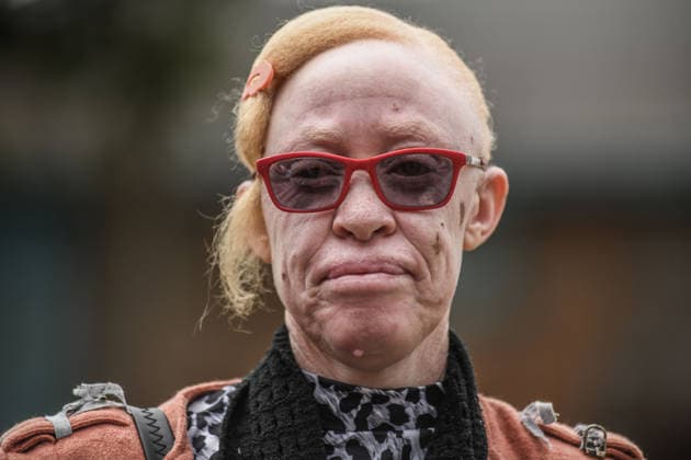 Kenya, International Albinism Awareness Day in Thika