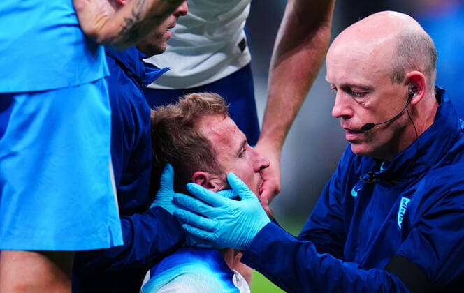 Mandatory Credit: Photo by Javier Garcia Shutterstock (13413805bh) Harry Kane suffers a facial injury Italy v England, UEFA Nations League, Group A3, International Football, Stadio Giuseppe Meazza, Milan, Italy - 23 Sep 2022 EDITORIAL USE ONLY No use with unauthorised audio, video, data, fixture lists, club league logos or live services. Online in-match use limited to 120 images, no video emulation. No use in betting, games or single club league player publications. Italy v England, UEFA Nations League, Group A3, International Football, Stadio Giuseppe Meazza, Milan, Italy - 23 Sep 2022 EDITORIAL USE ONLY No use with unauthorised audio, video, data, fixture lists, club league logos or live services. Online in-match use limited to 120 images, no video emulation. No use in betting, games or single club league player publications. Copyright: xJavierxGarcia Shutterstockx 13413805bh