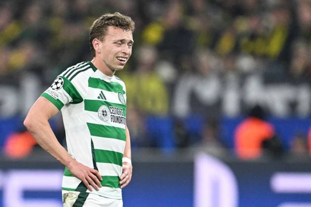 Alistair Johnston of Celtic shows a look of dejection Borussia Dortmund v Celtic, UEFA Champions League, Group Stage, Football, Signal Iduna Park, Dortmund, Germany, 01 Oct 2024 EDITORIAL USE ONLY No use with unauthorised audio, video, data, fixture lists, club league logos or live services. Online in-match use limited to 120 images, no video emulation. No use in betting, games or single club league player publications. Copyright: xMichaelxTitgemeyer Shutterstockx 14750161cy