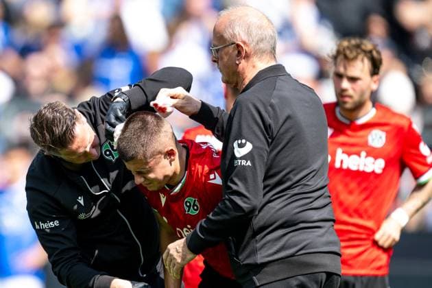 Nicolo Tresoldi Hannover 96, 09 has to leave the pitch injured, GER, SV Darmstadt 98 vs Hannover 96, 2 Bundesliga, Football, Matchday 30, Season 2024 2025, 20 04 2025 DFL REGULATIONS PROHIBIT ANY USE OF PHOTOGRAPHS as IMAGE SEQUENCES and or QUASI VIDEO GER, SV Darmstadt 98 vs Hannover 96, 2 Bundesliga, Football, Matchday 30, Season 2024 2025, 20 04 2025 Darmstadt Copyright: xEibner-Pressefoto FlorianxWiegandx EP_FWD