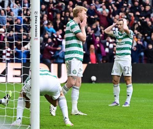 Celtic players react to the own goal Heart of Midlothian v Celtic, William Hill Scottish Premiership, Football, Tynecastle Park, Edinburgh, Scotland, UK - 26 Oct 2025Edinburgh Tynecastle Park United Kingdom EDITORIAL USE ONLY No use with unauthorised audio, video, data, fixture lists, club league logos or live services. Online in-match use limited to 120 images, no video emulation. No use in betting, games or single club league player publications. Copyright: xMarkxRunnacles Shutterstockx 15593438bu