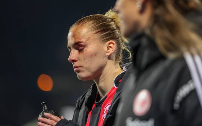 GER, Frankfurt, Eintracht Frankfurt vs TSG Hoffenheim, Google Pixel Bundesliga, Football, DFB, Season 2025 2026, Stadion am Brentanobad, 15 Matchday in picture Injury to Laura Freigang Eintracht Frankfurt Women 10 , blood, eye, injured, substitution DFB DFL REGULATIONS PROHIBIT ANY USE OF PHOTOGRAPHS AS IMAGE SEQUENCES AND OR QUASI VIDEO, 18 03 2026 Copyright: HMBxMedia HendrikxHamelau