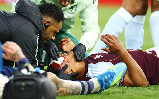 Ollie Watkins of Aston Villa seen with a cut to his head after a clash with Morato of Nottingham Forest. Aston Villa v Nottingham Forest, UEFA Europa League, Semi Final, Second Leg, Football, Villa Park, Birmingham, UK - 07 May 2026Birmingham Villa Park United Kingdom EDITORIAL USE ONLY No use with unauthorised audio, video, data, fixture lists, club league logos or live services. Online in-match use limited to 120 images, no video emulation. No use in betting, games or single club league player publications. Copyright: xJamesxMarsh Shutterstockx 16861510bf