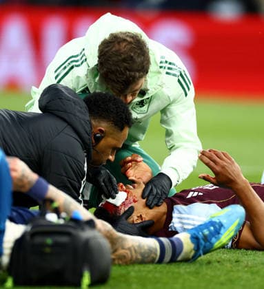 Ollie Watkins of Aston Villa seen with a cut to his head after a clash with Morato of Nottingham Forest. Aston Villa v Nottingham Forest, UEFA Europa League, Semi Final, Second Leg, Football, Villa Park, Birmingham, UK - 07 May 2026Birmingham Villa Park United Kingdom EDITORIAL USE ONLY No use with unauthorised audio, video, data, fixture lists, club league logos or live services. Online in-match use limited to 120 images, no video emulation. No use in betting, games or single club league player publications. Copyright: xJamesxMarsh Shutterstockx 16861510bh