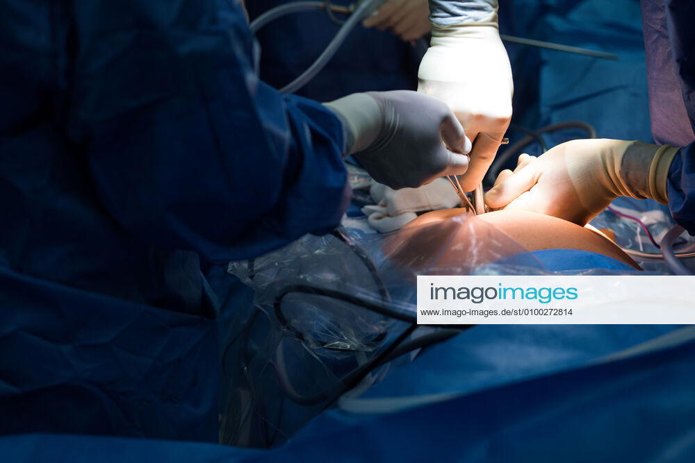 Abdominal surgery Düsseldorf Germany