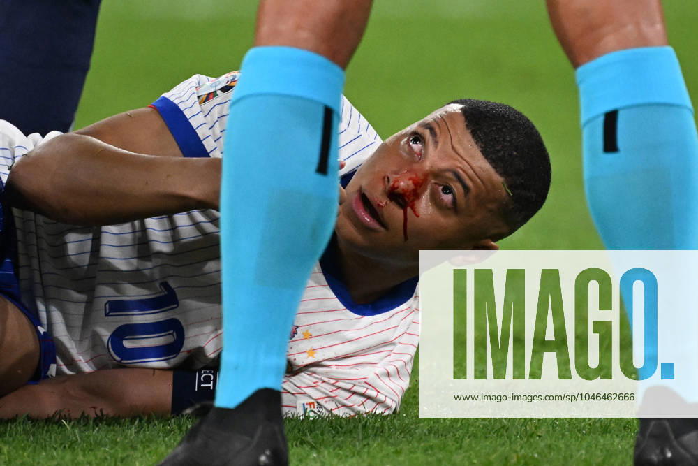 Football EM 2024, Austria France, v l Kylian Mbappe Lottin France with pain, injured, injury bleeding nose nosebleed Düsseldorf
