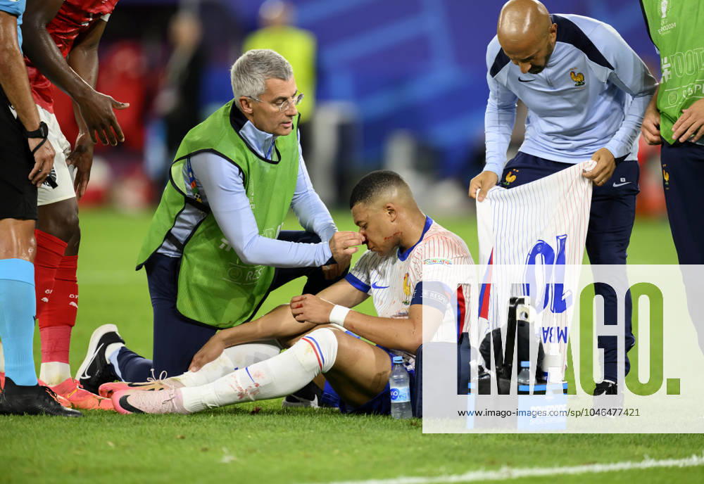 Kylian MBAPPE FRA with bloody nose, blood, injury, face, head, nasal bone fracture, being treated, injury, preliminary round 1 match day, group D, match M08, Austria AUT France FRA 0 1 on 17 06 2024 in Duesseldorf Germany European Football Championship 2024 from 14 06 14 07 2024 in Germany Â