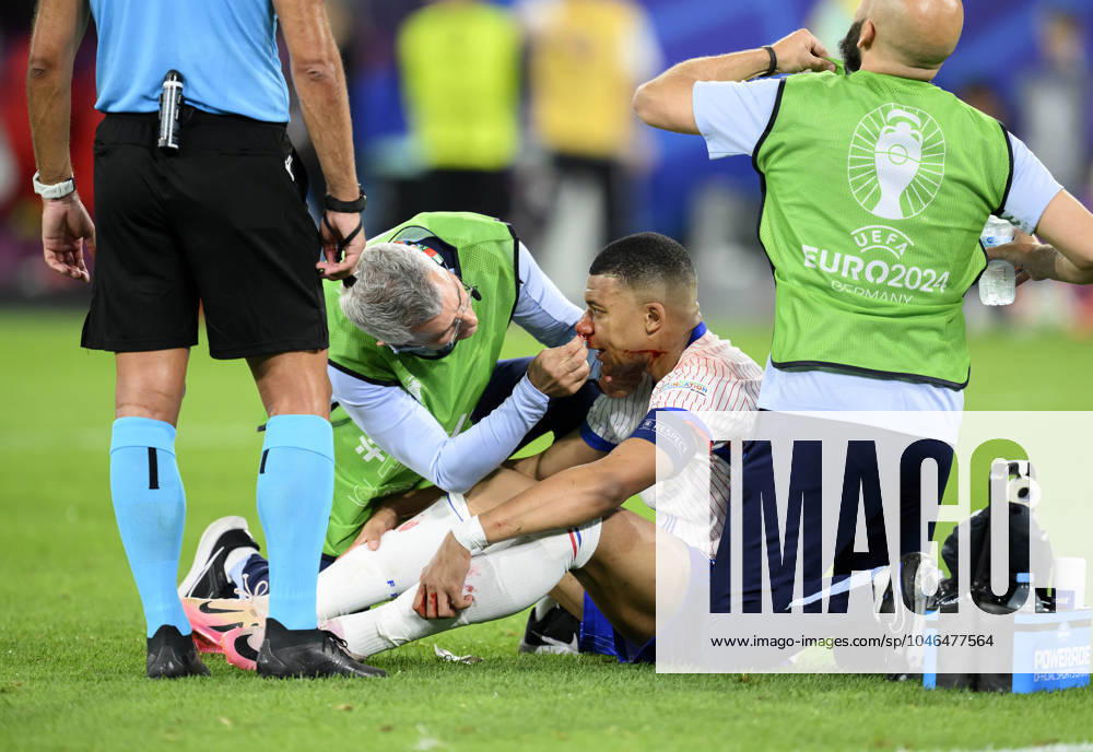 Kylian MBAPPE FRA with bloody nose, blood, injury, face, head, nasal bone fracture, being treated, injury, preliminary round 1 match day, group D, match M08, Austria AUT France FRA 0 1 on 17 06 2024 in Duesseldorf Germany European Football Championship 2024 from 14 06 14 07 2024 in Germany Â