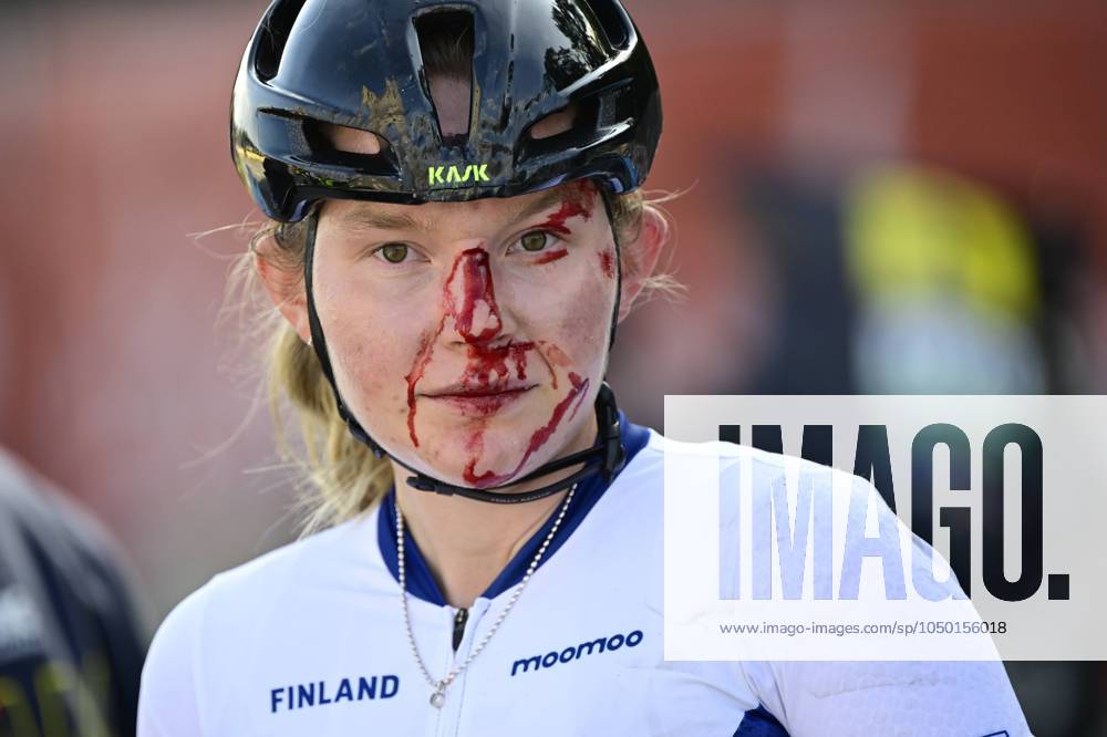 KW37 Finnish Turpeinen Viivi pictured with an injury after the Women s Junior Road Race at the European Championship, EM, Europameisterschaft 2024, in Hasselt, Sunday 15 September 2024. The UEC Road European Championships 2024 will take place from 11 to 15 september in Limburg, Belgium. DIRKxWAEM x100679296x