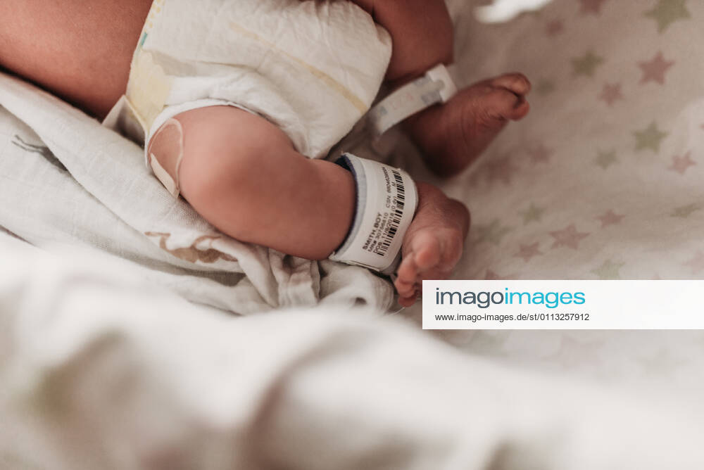 Close up image of newborn feet with hospital bracelet after birth San Diego, CA, United States CR_KESM210216-640861-01 ,model released, Symbolfoto