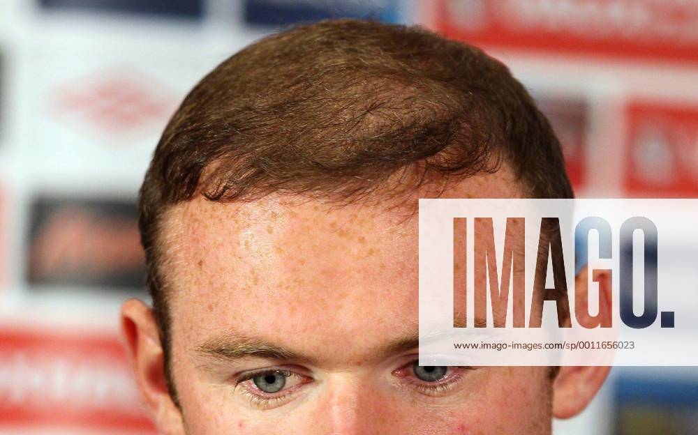 England s Wayne Rooney s hairline during his press conference..England Training - London Colney- 11 10 12 - Picture David Klein Sportimage .