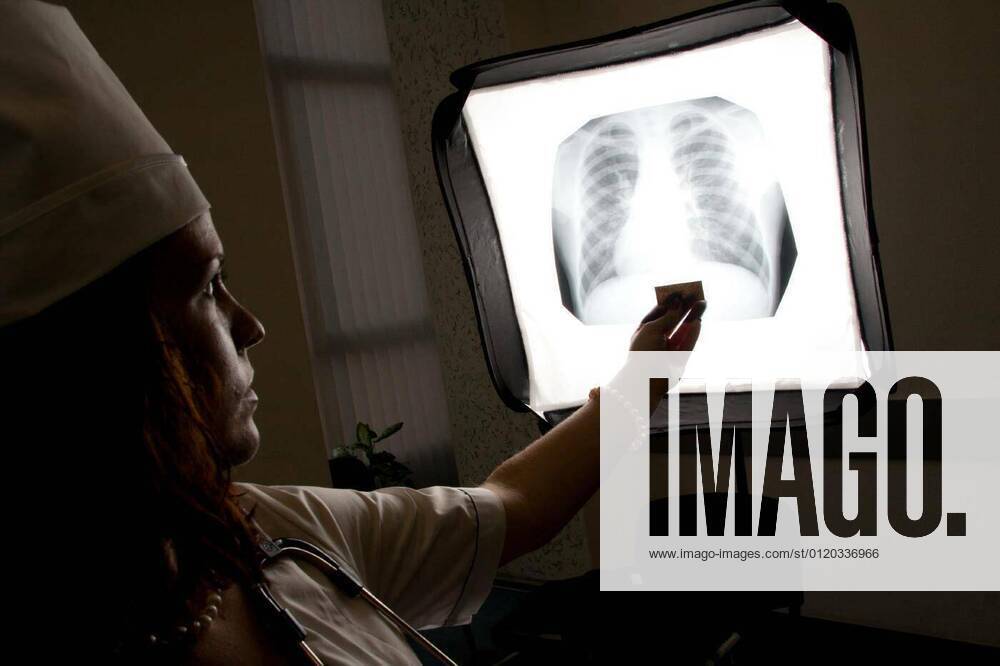 Doctor with chest X-ray model released, Symbolfoto, 06.02.2020 12:46:13,