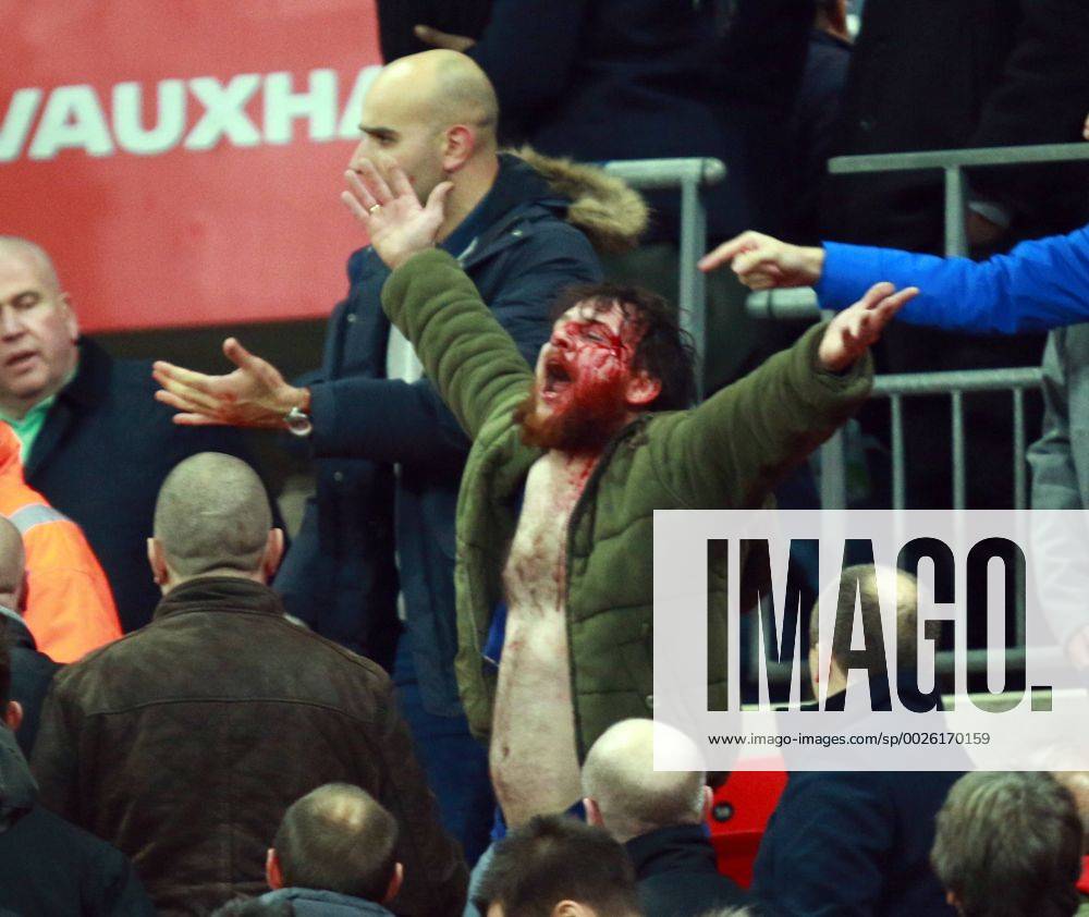 England v Scotland - FIFA World Cup WM Weltmeisterschaft Fussball 2018 Qualifier . . London, UK . . 11.11.2016 Fighting broke out amongst some England supporters, leaving one man covered in blood.