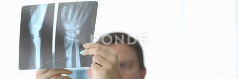 Close-up of female and male hands holding x-ray. Traumatologist and surgeon making diagnosis to patient. Practitioners discussing trauma. Traumatology and healthcare concept closeup, hand, holding, x-ray, skiagram, traumatologist, surgeon, diagnosis, patient, practitioner, discuss, trauma, traumatology, healthcare, concept, advice, colleague, work, hospital, look, xray, doctor, physician, examining, shadowgraph, therapist, medicine, disease, clinical, unhealthy, recovery, expert, clinic, specialist, healing, sick, illness, intern, practice, treatment, medic, medicines, professional, injury, diagnostic, cabinet, health, healthy