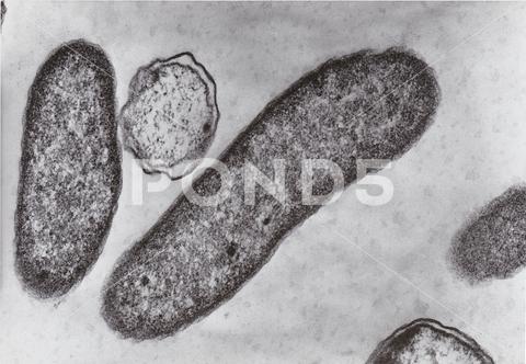 Scanning electron microscope photo - vibrio bacteria x76000 small, nano, tiny, microscope, micro, electron, science, research, scan, structure, study, surface, technology, treatment, zoom, view, physics, education, laboratory, magnification, metal, diseases, epidemic, experiment, ill, illness, microbiology, microbes, bacteria, medicine, cells, health, transmission, sickness, vibrio, virulent, gram negative, rods
