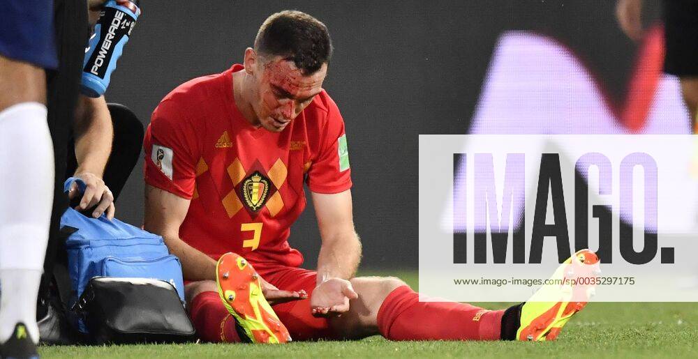 Belgium s Thomas Vermaelen, bleeding after a contact during a soccer game between Belgian national soccer team the Red Devils and England, Thursday 28 June 2018 in Kaliningrad, Russia, the third and last in Group G of the FIFA World Cup WM Weltmeisterschaft Fussball 2018. DIRKxWAEM x05374077x
