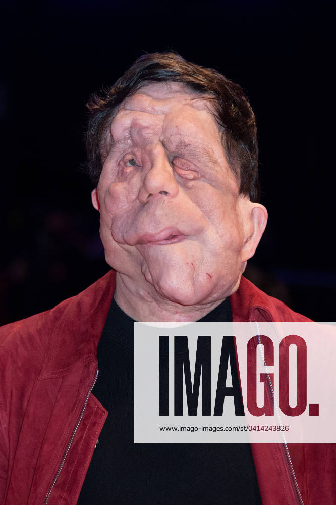 Berlinale A different Man Premiere Adam Pearson attending the A different Man Premiere during the 74th Berlinale International Film Festival Berlin at Grand Hyatt Hotel in Berlin, Germany, on February 16, 2024. Photo by Aurore Marechal ABACAPRESS.COM Berlin Germany