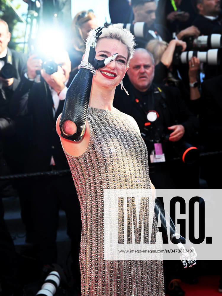Bilder des Jahres 2024, Entertainment 05 Mai Cannes, 77th Cannes Film Festival 2024, Fourth Evening - red carpet of the film Kinds of Kindness - In the photo: Bebe Vio