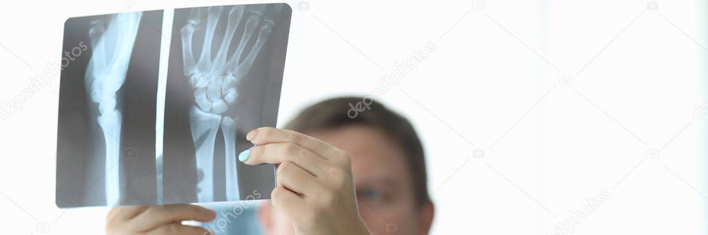 Close-up of female and male hands holding x-ray. Traumatologist and surgeon making diagnosis to patient. Practitioners discussing trauma. Traumatology and healthcare concept model released