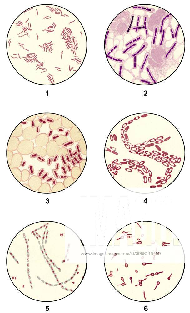 Bakterienausstriche von Krankheitserregern für die mikrobiologische Diagnostik, Mikropräparate aus der medizinischen Mikrobiologie, Stand der Wissenschaft um 1915, Abb.1: Cholera-Vibrionen oder Vibrio cholerae, Abb. 2: Milzbrandbazillen oder Bacillus anthracis, Abb. 3: Kapselbazillen, Abb. 4: Kartoffelbazillus oder Bacillus mesentericus, Abb. 5: Milzbrandbazillen oder Bacillus anthracis, Abb. 6: Tetanusbazillen oder Clostridium tetani iblhdf02266032