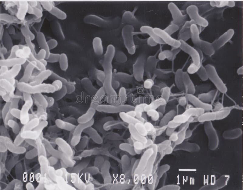 Scanning electron microscope photo of vibrio bacteria x8000, Scanning electron microscope photo - vibrio bacteria x8000