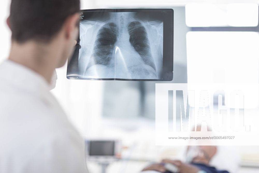 Doctor looking at x-ray image in a hospital room model released Symbolfoto property released ZEF006249