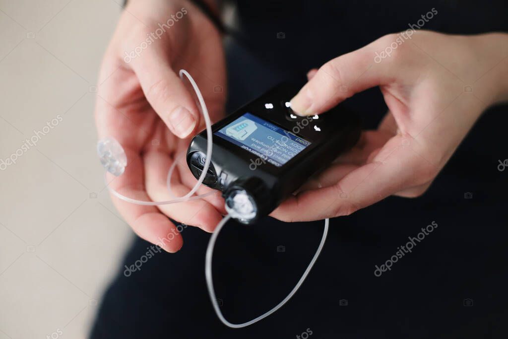 Woman holding her insulin pump in hands