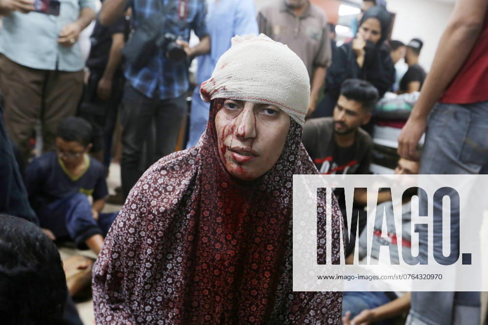 Palestinians incloud children injured in an Israeli attack on Nusairt camp are brought to Al Aqsa Martyrs Hospital Palestinians incloud children injured in an Israeli attack on Nusairt camp are brought to Al Aqsa Martyrs Hospital for treatment in Deir al Balah, Gaza Strip on September 24, 2024. Photo by Omar Ashtawy apaimages Dair EL-Balah Gaza Strip Palestinian Territory 240924_Dair_El-Balah_OSH_2_00(9)
