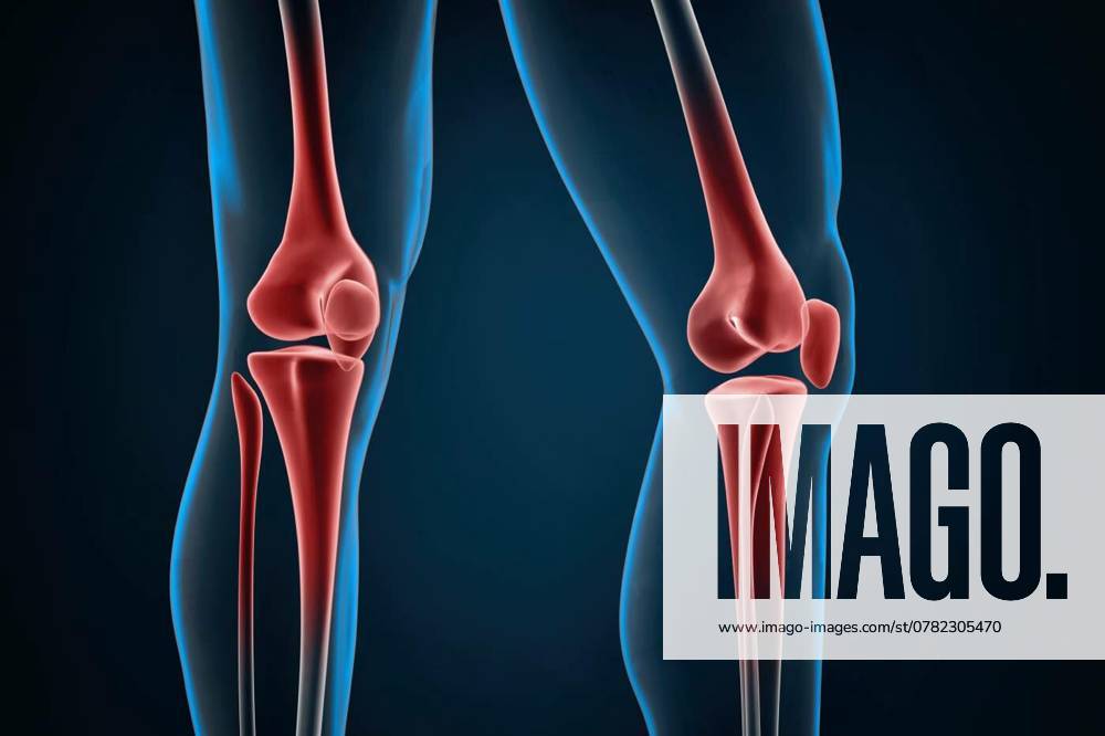 Injured knees close-up. 3D illustration, Injured knees close-up. 3D illustration., Injured knees close-up. 3D illustration., 12.09.2024,