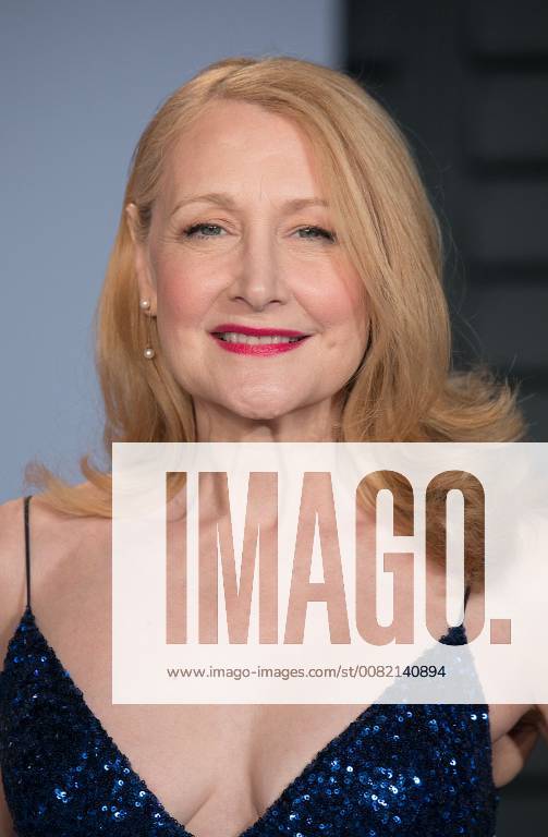 Beverly Hills, California, U.S - Patricia Clarkson on the red carpet of the 2018 Vanity Fair Oscar Party held at the Wallis Annenberg Center in Beverly Hills, California on Sunday March 4, 2018. Beverly Hills U.S. - ZUMAp124 20180304_zaa_p124_184