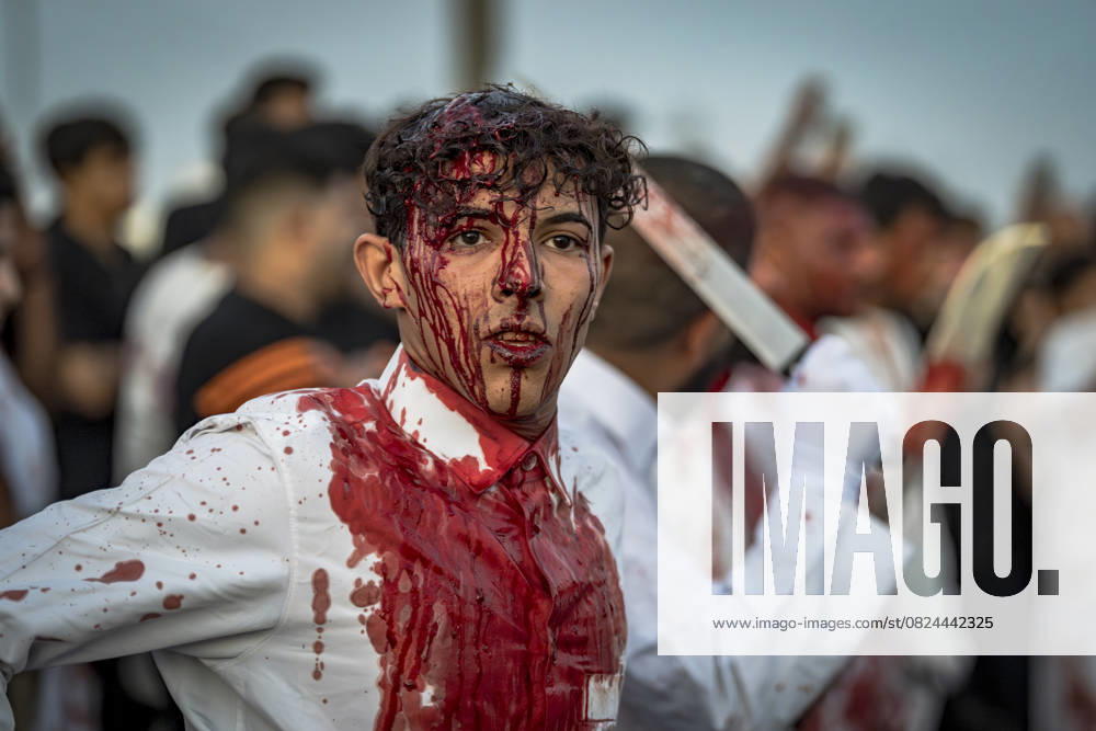 Tatbir Ritual Baghdad Iraq A man with a bloodied face stands among the procession in Baghdad, Iraq on July 6, 2025. Tatbir is a religious ritual practiced by some Shia Muslims on Ashura to mark the martyrdom of Imam Hussain, where participants strike their heads with swords to express grief and solidarity with the tragedy of Karbala. Baghdad Baghdad Iraq