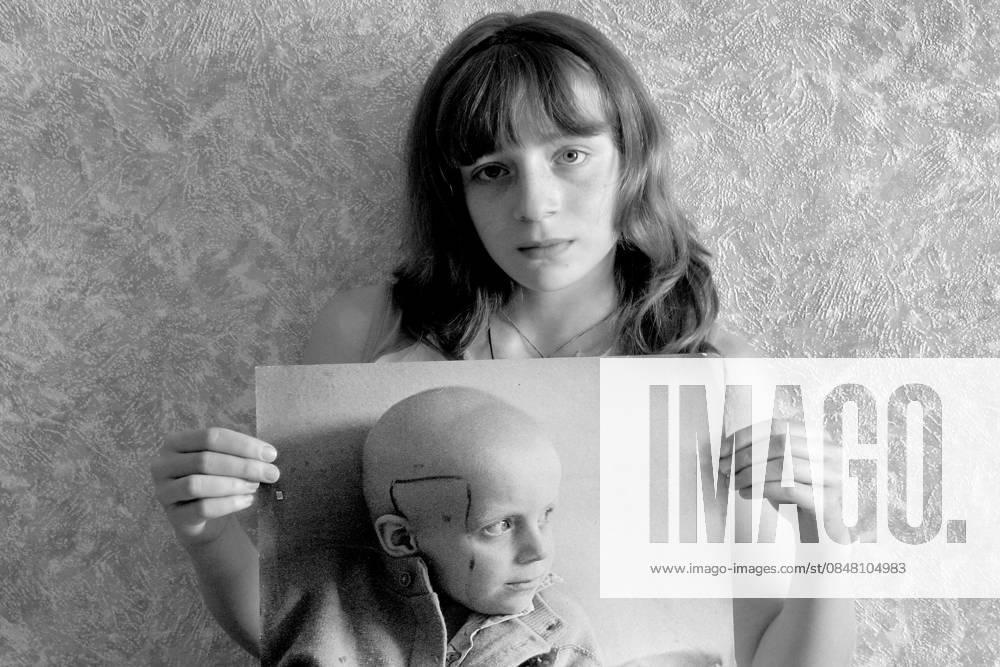 Chernobyl 20 Years After: Kids of Worst Human Made Disaster Katia Alekhno(15 years old) from Bobruisk-Belarus shows the picture of her self shot in 1986 year (when she was 6 )right after Chernobyl disaster when she got sick of leukaemia.Fortunately she survived...